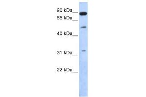 WB Suggested Anti-SENP5 Antibody Titration: 0. (SENP5 抗体  (Middle Region))