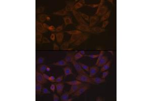 Immunofluorescence analysis of NIH-3T3 cells using Desmoglein 3 Rabbit mAb (ABIN7266741) at dilution of 1:100 (40x lens). (Desmoglein 3 抗体)