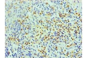 Immunohistochemical of paraffin-embedded human spleen using ABIN7168559 at dilution of 1:200 (S1A8 抗体)