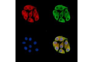 ABIN7095536 and ABIN7099593 staining Hela cells by IF/ICC. (FBXO4 抗体)