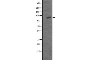 Western blot analysis of KIF23 expression in MKLP1 transfected 293T cell lysate,The lane on the left is treated with the antigen-specific peptide. (KIF23 抗体  (Internal Region))