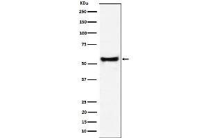Western blot analysis of PDCD7 expression in Jurkat cell lysate.