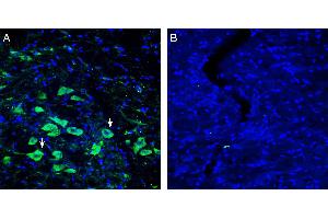 Expression of Platelet-activating factor receptor in rat substantia nigra pars compacta (SNC). (PTAFR 抗体  (Extracellular))