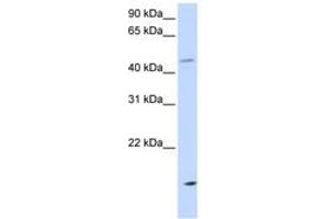 Image no. 1 for anti-Cholesteryl Ester Transfer Protein (CETP) (AA 36-85) antibody (ABIN6743588) (CETP 抗体  (AA 36-85))