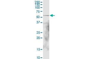 ALDH1A1 MaxPab rabbit polyclonal antibody.