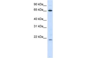 Western Blotting (WB) image for anti-Nuclear Import 7 Homolog (NIP7) antibody (ABIN2462264) (NIP7 抗体)