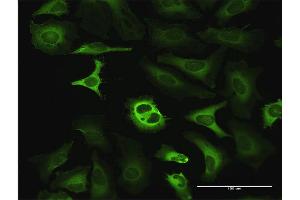 Immunofluorescence of purified MaxPab antibody to G6PD on HeLa cell. (Glucose-6-Phosphate Dehydrogenase 抗体  (AA 1-515))