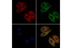 ABIN6263153 and ABIN6277995 staining Hela cells by IF/ICC.