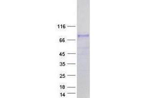 Western Blotting (WB) image for Nuclear Receptor Coactivator 4 (NCOA4) (Transcript Variant 3) protein (Myc-DYKDDDDK Tag) (ABIN2726905)