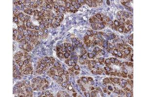 Immunohistochemistry (IHC) image for anti-Bone Morphogenetic Protein 3 (BMP3) (Internal Region) antibody (ABIN6260282)