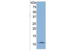 WB of Protein Standard: different control antibodies  against Highly purified E. (IL-6 Receptor ELISA 试剂盒)