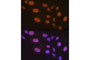 Immunofluorescence analysis of U-2 OS cells using PTBP2 Rabbit mAb (ABIN7269465) at dilution of 1:100 (40x lens). (PTBP2 抗体)
