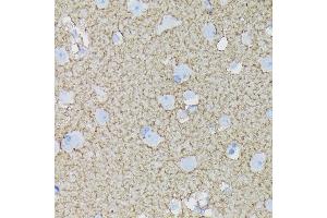 Immunohistochemistry (IHC) image for anti-Solute Carrier Family 1 (Glial High Affinity Glutamate Transporter), Member 3 (SLC1A3) antibody (ABIN7270394)