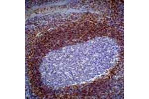 Immunohistochemistry (IHC) image for anti-B-Cell CLL/lymphoma 2 (BCL2) antibody (ABIN7305040)