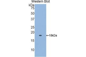 Western blot analysis of the recombinant protein. (Retinol Binding Protein 5 抗体  (AA 2-135))