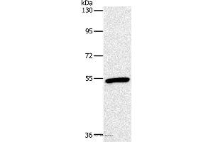 Western blot analysis of Mouse heart tissue, using OXTR Polyclonal Antibody at dilution of 1:866 (Oxytocin Receptor 抗体)