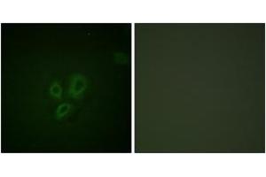 Immunofluorescence (IF) image for anti-Cardiac Troponin I (TNNI3) (AA 5-54) antibody (ABIN2888707) (TNNI3 抗体  (AA 5-54))