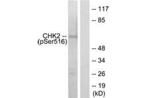 Western Blotting (WB) image for anti-Checkpoint Kinase 2 (CHEK2) (pSer516) antibody (ABIN2888383) (CHEK2 抗体  (pSer516))