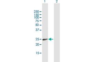 Western Blot analysis of RAB31 expression in transfected 293T cell line by RAB31 MaxPab polyclonal antibody. (RAB31 抗体  (AA 1-195))