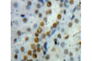 Used in DAB staining on fromalin fixed paraffin-embedded Kidney tissue (HMGB1 抗体  (AA 1-215))