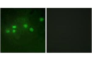 Immunofluorescence analysis of A549 cells, using ELF1 Antibody. (ELF1 抗体  (AA 537-586))