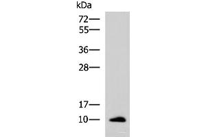 Western blot analysis of Human ileum tissue lysate using CCL13 Polyclonal Antibody at dilution of 1:700