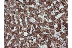 Immunohistochemistry (IHC) image for anti-Acetyl-CoA Acyltransferase 2 (ACAA2) antibody (ABIN1495726) (ACAA2 抗体)