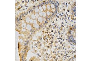 Immunohistochemistry (IHC) image for anti-Protein Kinase C, epsilon (PRKCE) (AA 488-737) antibody (ABIN3022942)