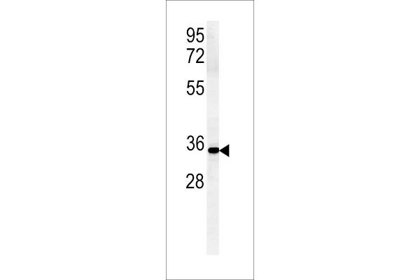 ZDHHC2 抗体  (N-Term)