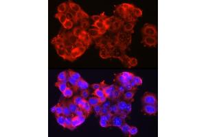 Immunofluorescence (IF) image for anti-serpin Peptidase Inhibitor, Clade B (Ovalbumin), Member 3 (SERPINB3) (AA 1-230) antibody (ABIN6147587)