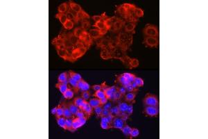 Immunofluorescence analysis of HepG2 cells using SSC/SerpinB3 Rabbit pAb (ABIN6131348, ABIN6147587, ABIN6147588 and ABIN6221070) at dilution of 1:100 (40x lens). (SERPINB3 抗体  (AA 1-230))