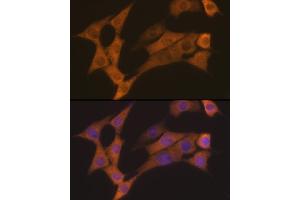 Immunofluorescence analysis of NIH-3T3 cells using Cyclin B2 Rabbit mAb (ABIN7266557) at dilution of 1:100 (40x lens). (Cyclin B2 抗体)
