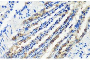 Immunohistochemistry of paraffin-embedded Mouse lung using KMT2E Polyclonal Antibody at dilution of 1:200 (40x lens).