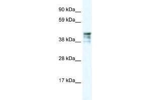 WB Suggested Anti-KRT15 Antibody Titration: 0. (KRT15 抗体  (C-Term))