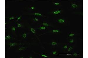 Immunofluorescence of monoclonal antibody to TGIF2 on HeLa cell. (TGIF2 抗体  (AA 114-175))