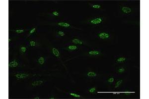 Immunofluorescence of monoclonal antibody to TGIF2 on HeLa cell.