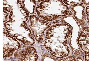 ABIN6278956 at 1/100 staining Human kidney tissue by IHC-P.
