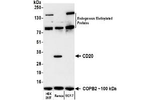 Western Blotting (WB) image for anti-Biotin antibody (ABIN7795728) (Recombinant Biotin 抗体)