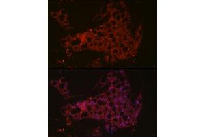 Immunofluorescence analysis of mouse brown adipose cells using UCP1 Rabbit pAb (ABIN6128899, ABIN6149883, ABIN6149885 and ABIN6221561) at dilution of 1:50 (40x lens). (UCP1 抗体  (AA 1-307))
