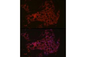 Immunofluorescence analysis of mouse brown adipose cells using UCP1 Rabbit pAb (ABIN6128899, ABIN6149883, ABIN6149885 and ABIN6221561) at dilution of 1:50 (40x lens). (UCP1 抗体  (AA 1-307))