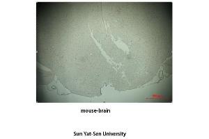 Immunohistochemistry (IHC) analysis: Please contact us for more details. (TH 抗体  (Tyr161))