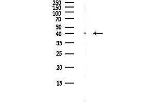 anti-Chemokine (C-C Motif) Receptor 3 (CCR3) (C-Term) antibody