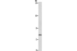 Western Blotting (WB) image for anti-ATP-Binding Cassette, Sub-Family B (MDR/TAP), Member 6 (ABCB6) antibody (ABIN2428945) (ABCB6 抗体)