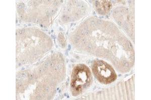 ABIN6266916 at 1/100 staining human kidney tissue sections by IHC-P. (TNFAIP2 抗体)