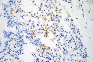 Immunohistochemistry was performed on paraffin-embedded mouse lung using caveolin 1 antibody (ABIN7797944), 1:200). (Recombinant Caveolin-1 抗体)