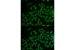 Immunofluorescence analysis of U2OS cell using MPP2 antibody. (MPP2 抗体)