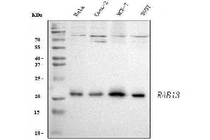 Western blot analysis of RAB13 using anti-RAB13 antibody (ABIN3043916).