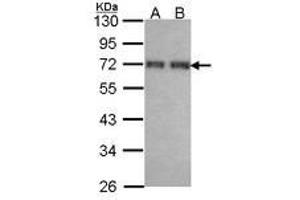 Image no. 2 for anti-Coiled-Coil Domain Containing 6 (CCDC6) (AA 1-232) antibody (ABIN467500) (CCDC6 抗体  (AA 1-232))