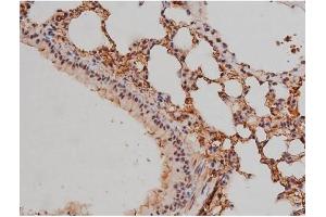 Immunohistochemistry (IHC) image for anti-Sp1 Transcription Factor (SP1) (pThr453) antibody (ABIN6256566)
