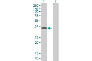 Lane 1: INHBE transfected lysate ( 36. (INHBE(-SP) 293T Cell Transient Overexpression Lysate(Denatured))